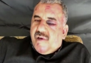 آثار شکنجه بر چهره خلبان سوری + فیلم