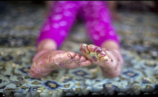 مرگ خاموش کودکان جنوب کرمان