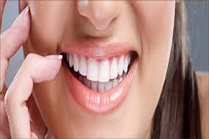 10 نکته‌ای که حتما باید به دندانپزشکتان بگویید!