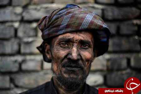 از چشمان دو رنگ پسربچه یمنی تا اقامت شبانه در آکواریوم کوسه&zwnj;ها