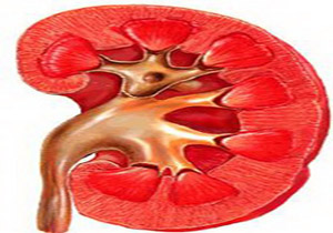 بیماری های کلیه در کمین حداقل 40 میلیون ایرانی است