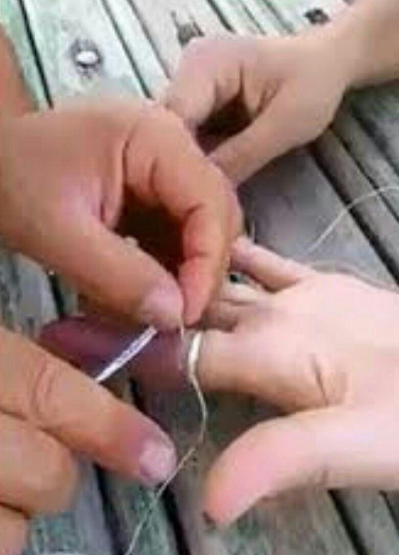 آتش نشانان مانع بریده شدن انگشت یک مصدوم شدند+عکس