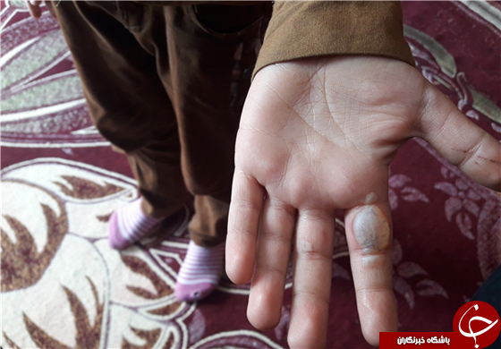 تنبیه بدنی دانش&zwnj;آموز چاروسایی توسط معلم +عکس