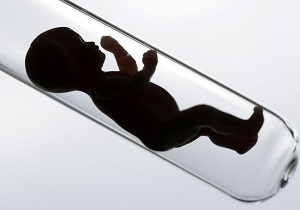نکات مهم درباره روش درمان ناباروری "آی وی اف"/ نوزادان IVF بیشتر پسر هستند!