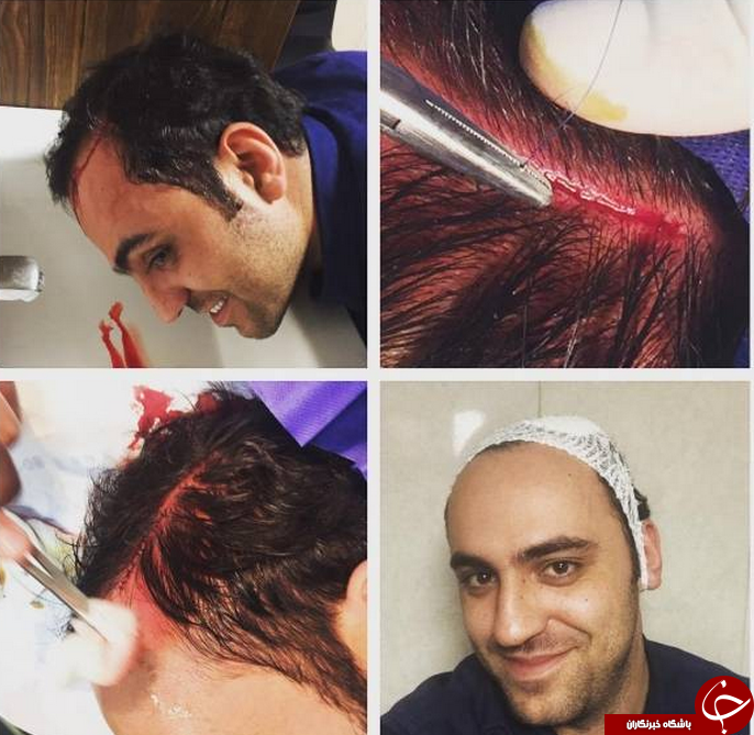 عذرخواهی گوینده خبر ورزشی بابت انتشار عکس نامناسب در اینستاگرامش