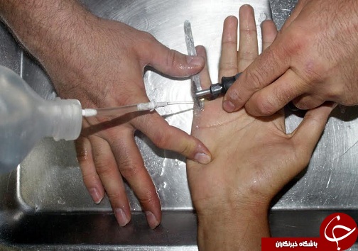 انگشتر دردسر ساز