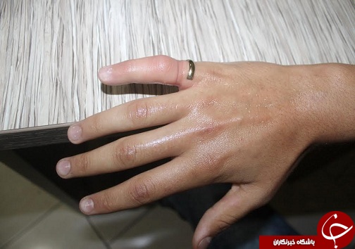 انگشتر دردسر ساز
