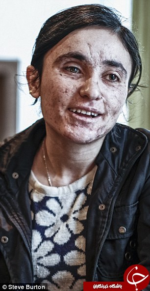 روایتی تلخ از سرنوشت دختر ایزدی/