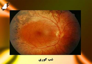 اختلالی در تاریکی های شب