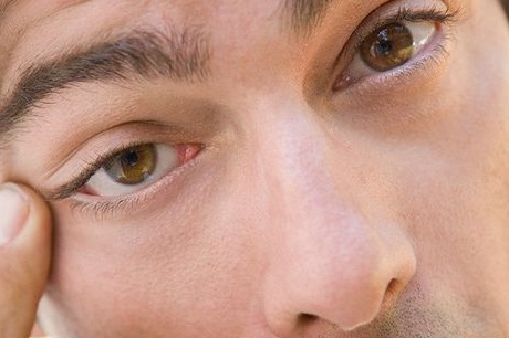 غول آلودگی هوا دوباره بیدار شد/ مراقب چشم&zwnj;&zwnj;هایتان باشید