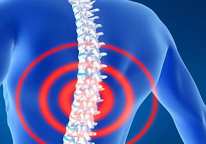 بیماری‌های ستون فقرات سالانه میلیاردها ریال هزینه در پی دارد
