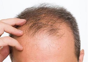 با این معجون خانگی حتی یک تار مو هم از سرتان کم نمی‌شود+دستورالعمل