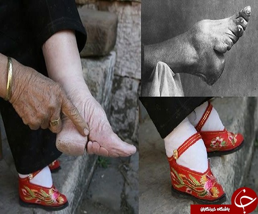 عجیب ترین مدهای جهان که تاکنون ندیده اید! / از کاشت جواهرات در چشم تا دندان&zwnj;های یائه&zwnj;با + تصاویر