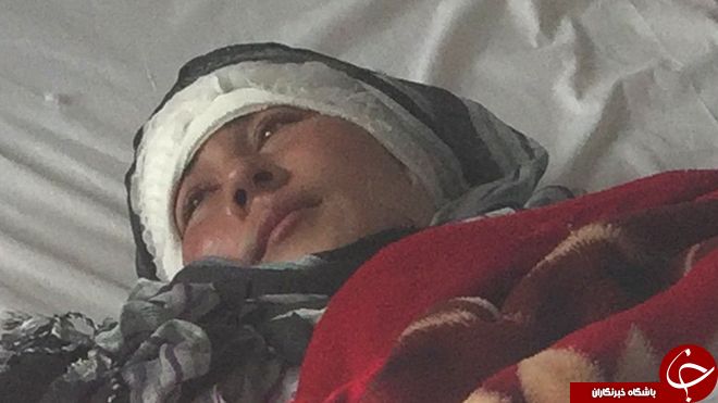 مرد افغانی گوش&zwnj;های زنش را برید