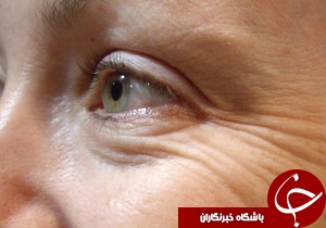 عاملان و قاتلان چین و چروک
