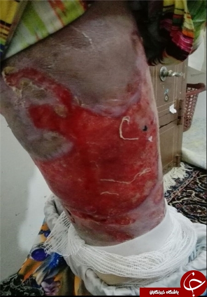 جسد بقچه&zwnj;پیچ شده الینا/ تصاویری که شاید مسئولان را بیدار کند 16+