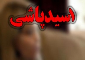 زن اسیدپاش قصاص می‌شود