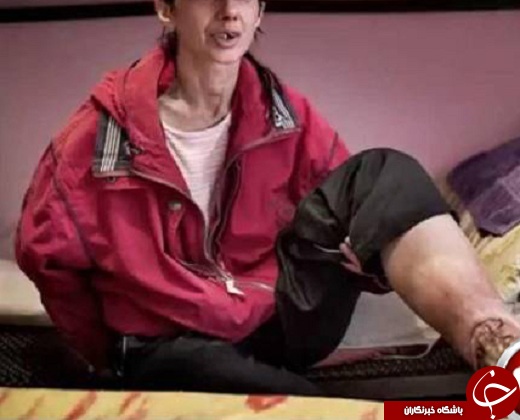 وحشتناک ترین ماده مخدر جهان کروکودیل آدمخوار + عکس