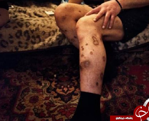 وحشتناک ترین ماده مخدر جهان کروکودیل آدمخوار + عکس