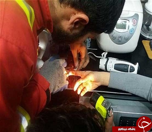 انگشت دختر در گوشت&zwnj;کوب برقی گیر کرد +عکس