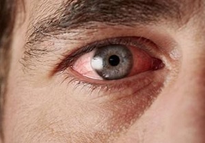 دیابت چه بلایی سر چشم‌ها می‌آورد؟