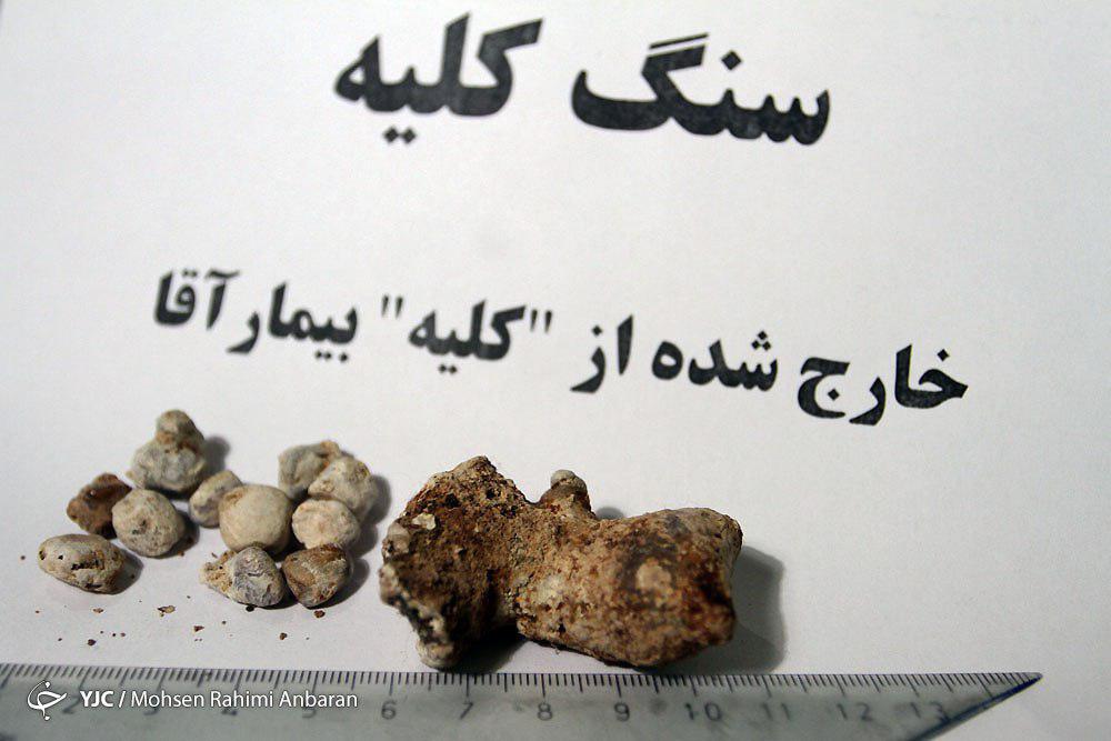 اجسامی که با تلاش پزشکان ازبدن بیماران خارج می&zwnj;شود