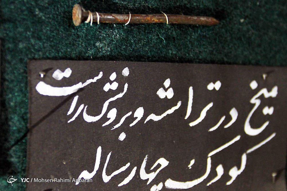 اجسامی که با تلاش پزشکان ازبدن بیماران خارج می&zwnj;شود