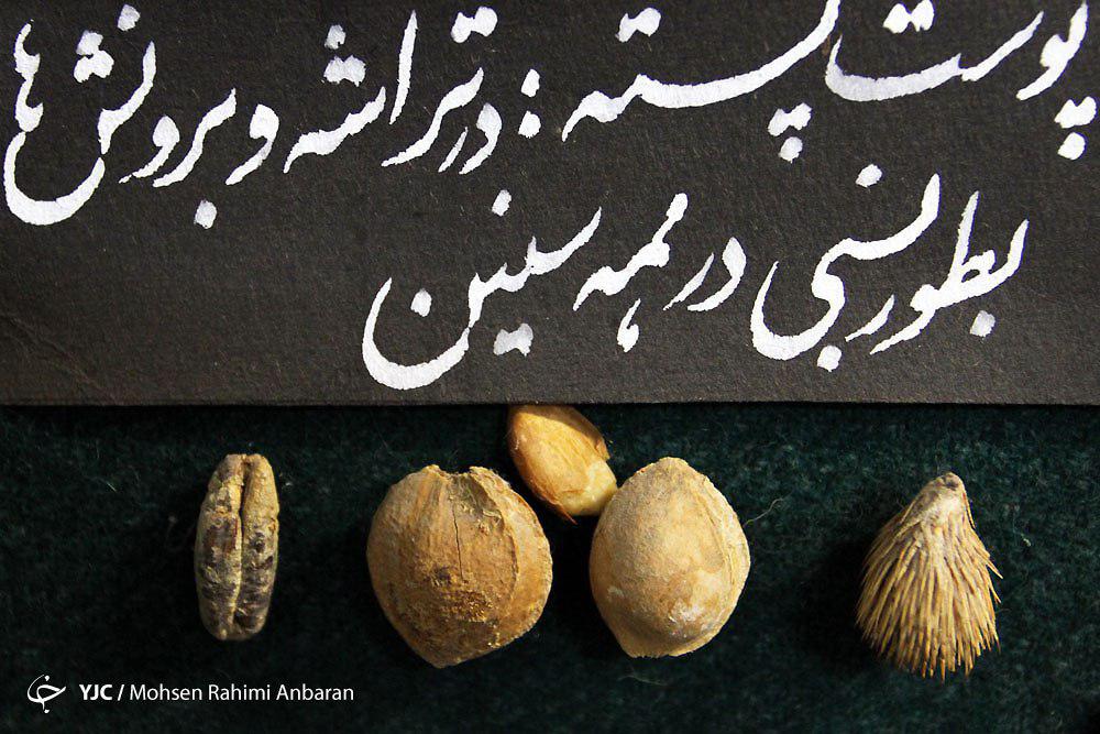 اجسامی که با تلاش پزشکان ازبدن بیماران خارج می&zwnj;شود