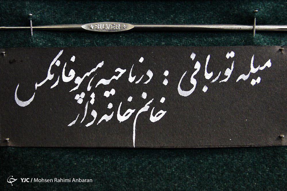 اجسامی که با تلاش پزشکان ازبدن بیماران خارج می&zwnj;شود