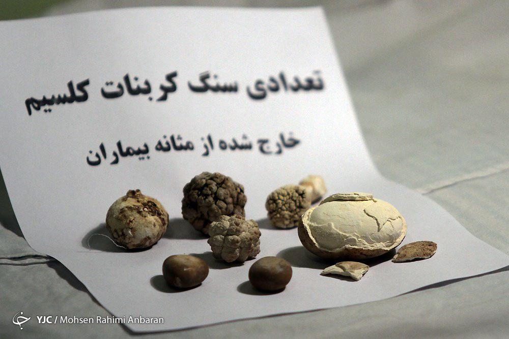 اجسامی که با تلاش پزشکان ازبدن بیماران خارج می&zwnj;شود