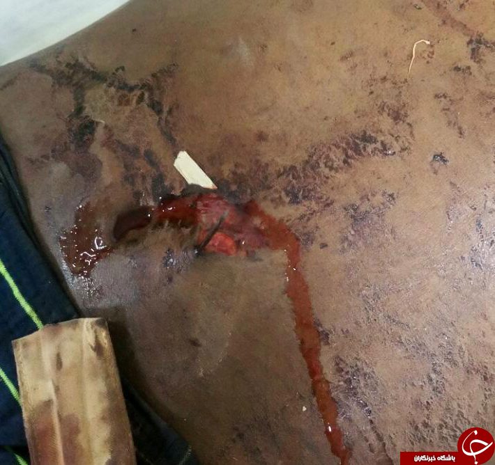 مرد جوان توسط قبیله خودش مورد اصابت پیکان قرار گرفت+ تصاویر(18+)
