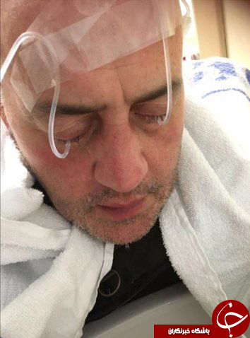 دلیل نابینا شدن این مرد در رستوران چه بود؟+فیلم