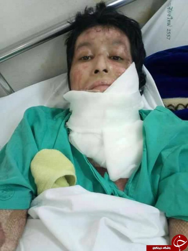 زنی که در شعله&zwnj;های حسادت همسرش سوخت شد/ تصاویر (+ ۱۸)