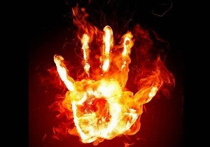 نکات طلایی برای پیشگیری از سوانح سوختگی چهارشنبه‌سوری