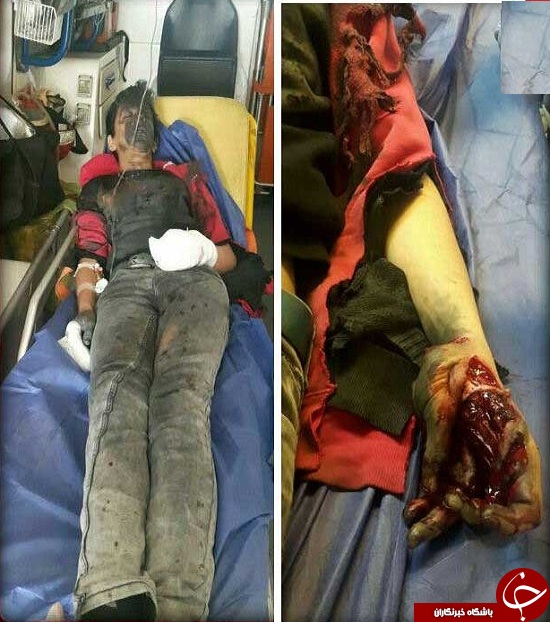 جوانی با دست متلاشی به بیمارستان رفت + عکس(14+)