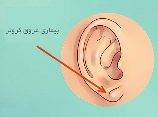 آنچه گوش ها درباره سلامتی می گویند