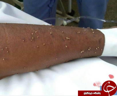 حمله مرگبار زنبورها، زن سالخورده را به کام مرگ کشاند + تصاویر