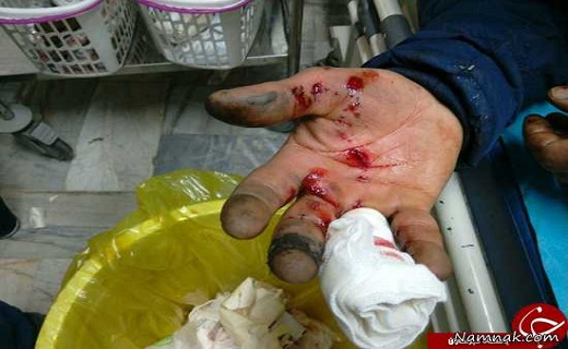 رشد ۴۳ درصدی آسیب دیدگان حوادث چهار شنبه آخر سال