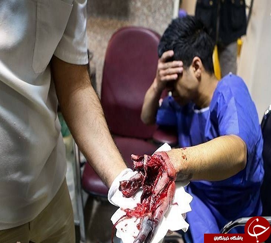تصاویری وحشتناک از مصدومین چهارشنبه سوری سال های گذشته + (16+)