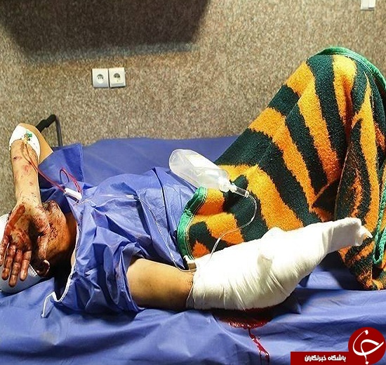 تصاویری وحشتناک از مصدومین چهارشنبه سوری سال های گذشته + (16+)