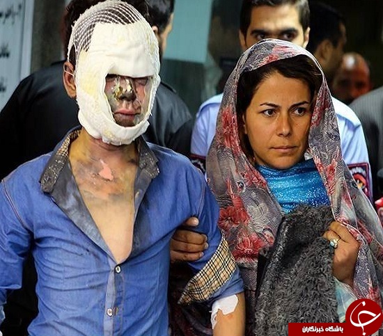 تصاویری وحشتناک از مصدومین چهارشنبه سوری سال های گذشته + (16+)