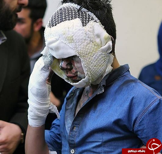 تصاویری وحشتناک از مصدومین چهارشنبه سوری سال های گذشته + (16+)