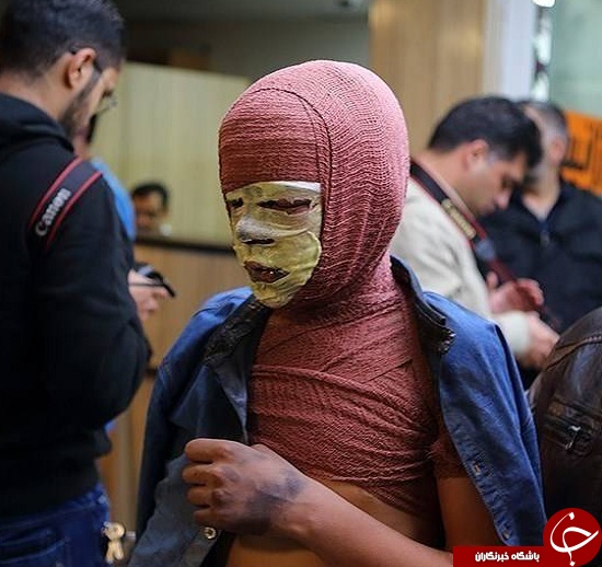 تصاویری وحشتناک از مصدومین چهارشنبه سوری سال های گذشته + (16+)