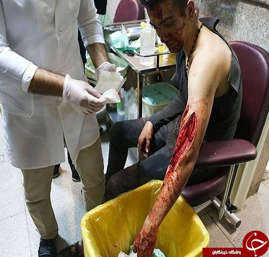 تصاویری وحشتناک از مصدومین چهارشنبه سوری سال های گذشته + (16+)