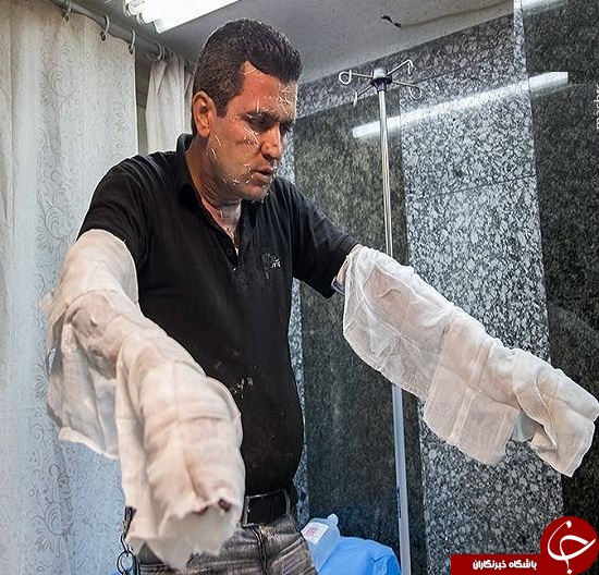 تصاویری وحشتناک از مصدومین چهارشنبه سوری سال های گذشته + (16+)