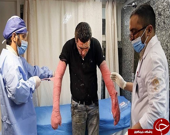 تصاویری وحشتناک از مصدومین چهارشنبه سوری سال های گذشته + (16+)