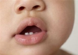 تولید ژل گیاهی تسکین‌دهنده درد لثه کودکان توسط نخبگان دانشگاهی