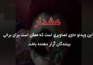 خورده شدن صورت زنی توسط باکتری گوشتخوار + فیلم (18+)