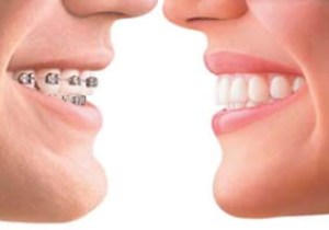 پیشگیری از عادات غلط برای داشتن دندان های زیبا