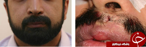 عجیب ترین عمل های جراحی پلاستیک/ از درشت کردن چشم تا جوان کردن صدا